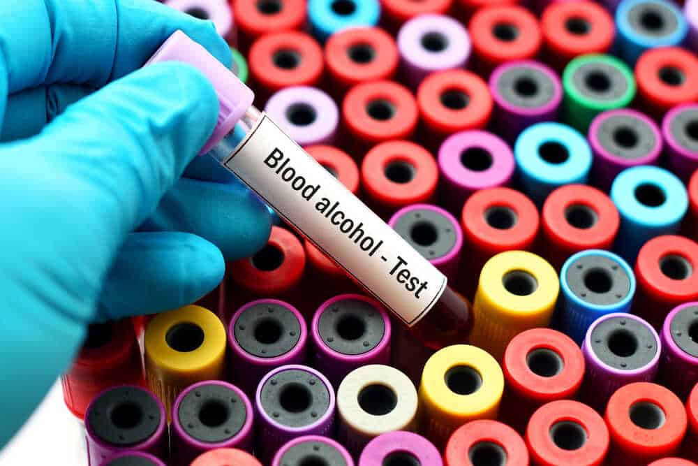 A gloved hand holds a test tube labeled "Blood alcohol Test" above an array of colorful, capped test tubes. The background consists of numerous similar test tubes arranged closely together. If you need legal counsel regarding results like these, consider consulting a Criminal Defense Attorney in Cecil County.